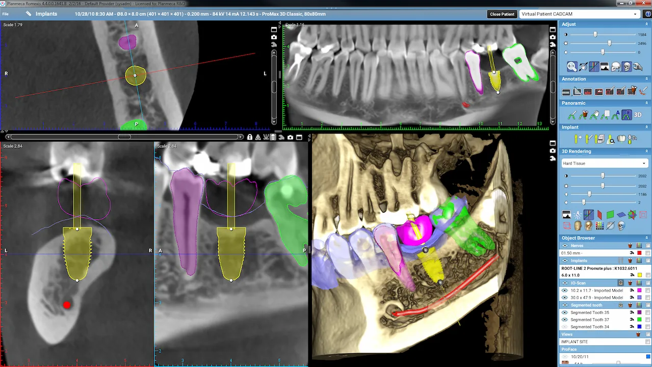 Tecnología dental 3d maxilofacial Pontevedra