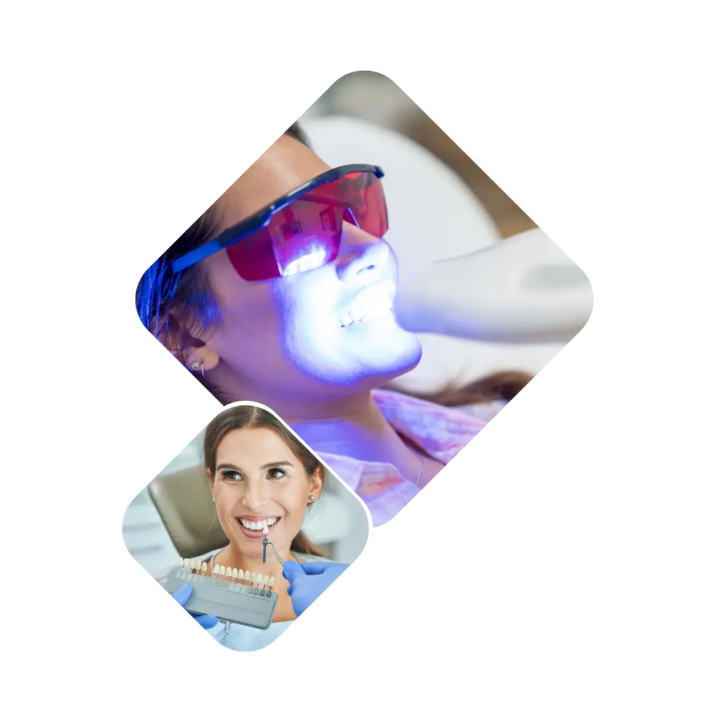 Tratamiento blanqueamiento dental en Pontevedra