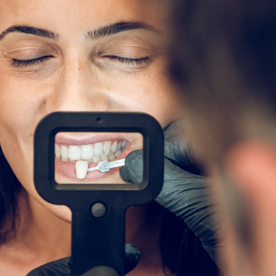 Especialista carillas dentales Pontevedra probando tono con paciente