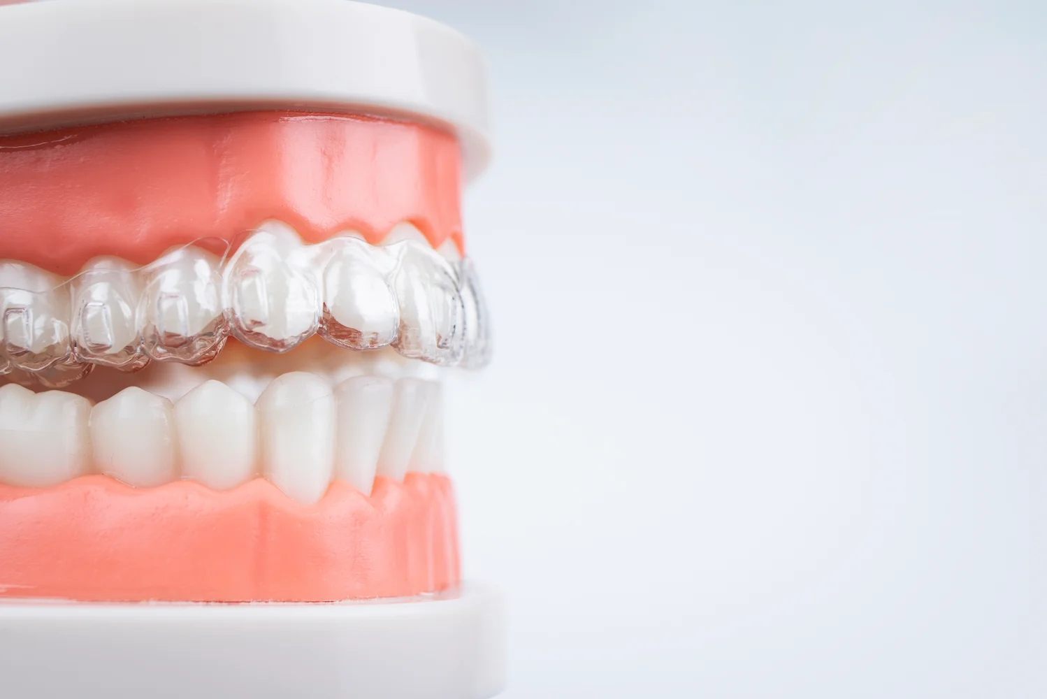Alineadores Invisalign en Pontevedra