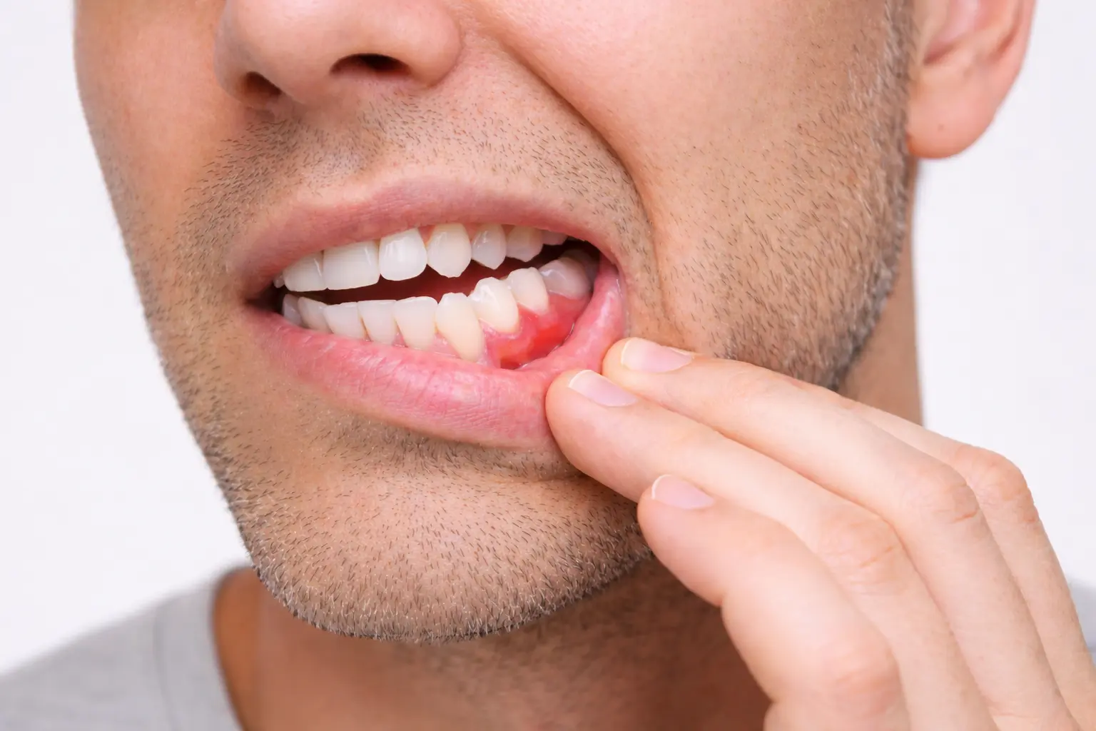 Periodoncia en Pontevedra